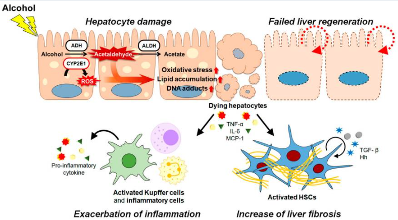 酒精及其代謝物通過各種途徑和/或機制共同促進ALD的發(fā)病機制。（如圖1）