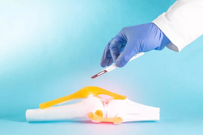 間充質(zhì)干細胞在人類半月板修復中的潛在用途:當前見解