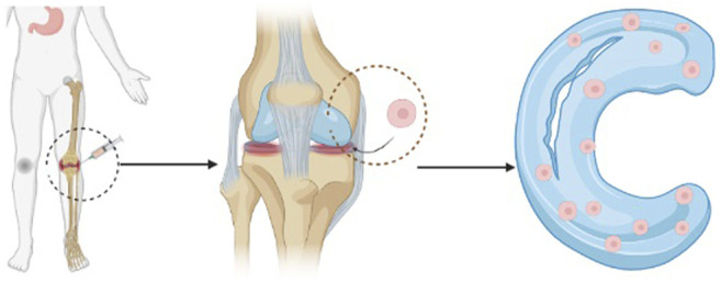 圖1:干細胞注射方法的過程示意圖。