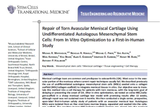 間充質干細胞能夠幫助修復受損的半月板組織，不用手術切除受傷部位也能讓膝關節功能恢復正常。