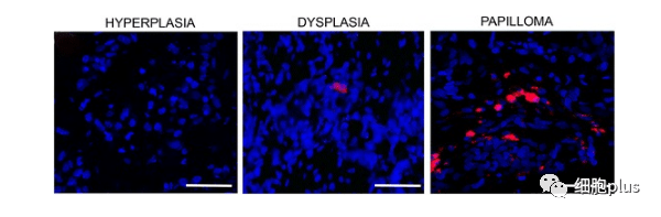 4?全身注射同種異體間充質干細胞很少進入癌前病變 4?全身注射同種異體間充質干細胞很少進入癌前病變