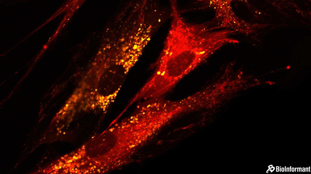 干細(xì)胞的好處| 間充質(zhì)干細(xì)胞 (MSC) 相對(duì)于其他干細(xì)胞類型的優(yōu)勢 干細(xì)胞的好處| 間充質(zhì)干細(xì)胞 (MSC) 相對(duì)于其他干細(xì)胞類型的優(yōu)勢