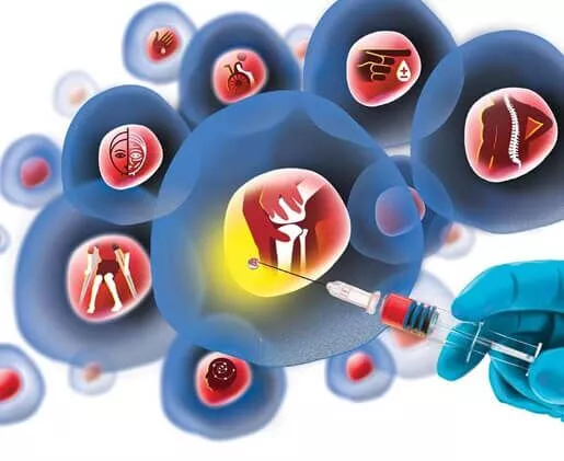 干細胞治療脊髓損傷的程序是什么 干細胞治療脊髓損傷的程序是什么