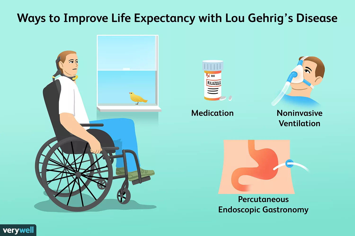 改善漸凍癥預(yù)期壽命的方法
