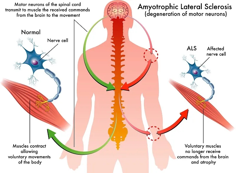 脊髓損傷及治療 脊髓損傷及治療