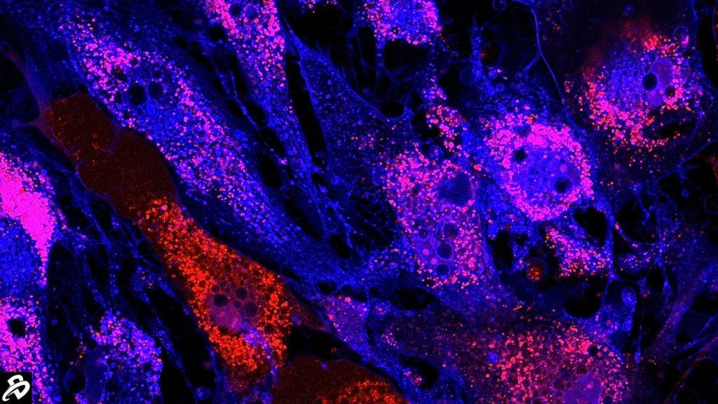 干細(xì)胞治療:未來醫(yī)學(xué)的新星,2030年獲批數(shù)量或?qū)⑼黄?5款 干細(xì)胞治療:未來醫(yī)學(xué)的新星,2030年獲批數(shù)量或?qū)⑼黄?5款