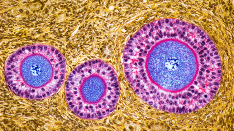 卵巢早衰體征和癥狀是什么？及其治療方法