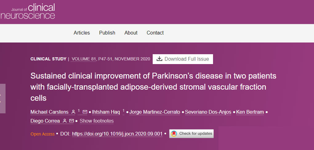 面部移植脂肪來源的基質血管成分細胞后,兩名帕金森病患者病情持續改善 面部移植脂肪來源的基質血管成分細胞后,兩名帕金森病患者病情持續改善