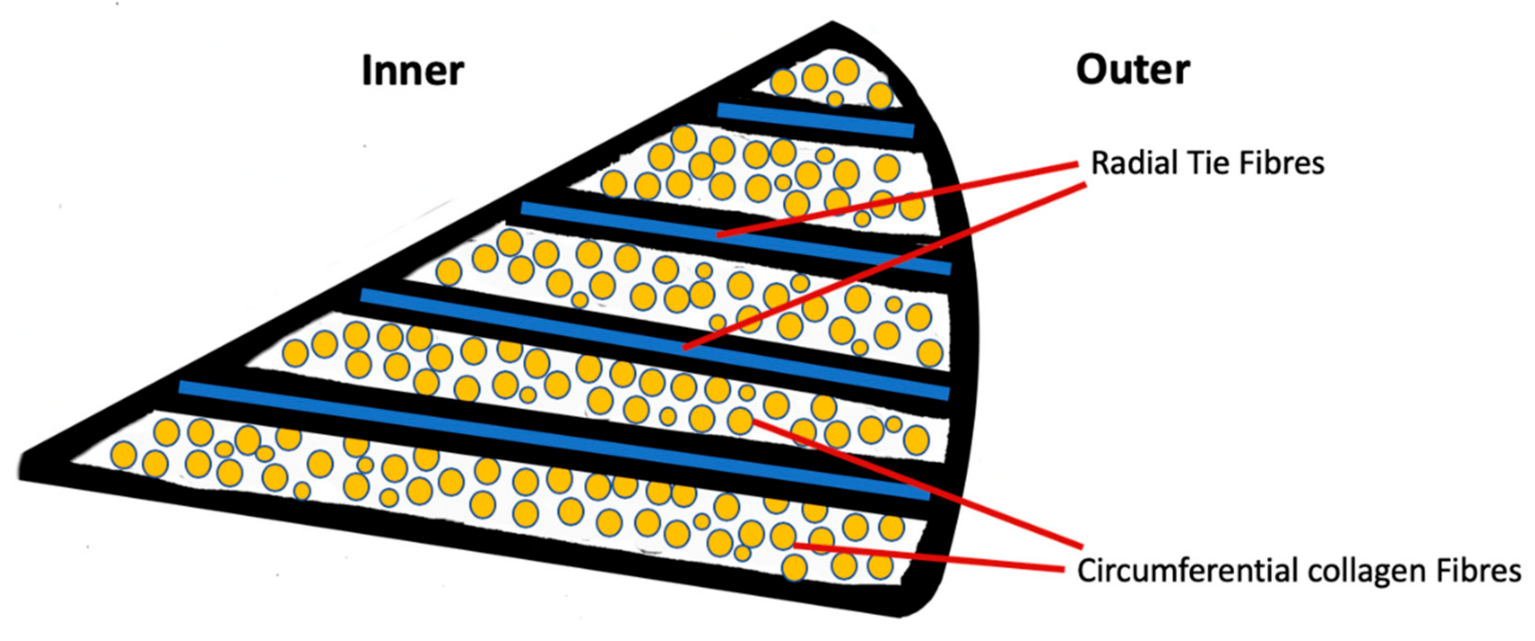 圖2:半月板的示意性橫截面圖,顯示了膠原纖維和徑向系纖維的圓周排列。 圖2:半月板的示意性橫截面圖,顯示了膠原纖維和徑向系纖維的圓周排列。