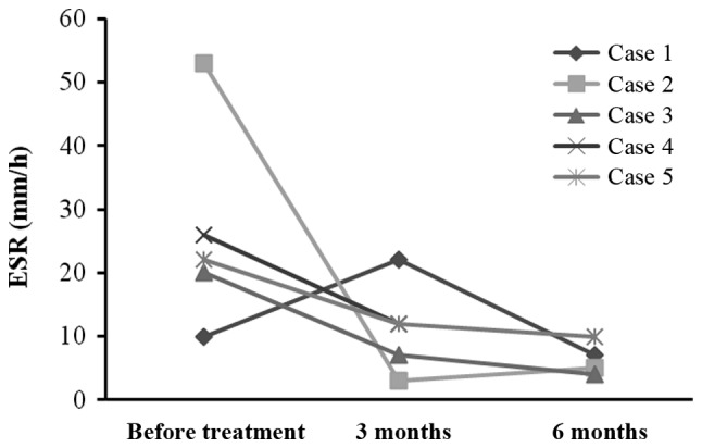 圖3:每位患者在治療前后的ESR。3例患者血沉明顯下降 圖3:每位患者在治療前后的ESR。3例患者血沉明顯下降