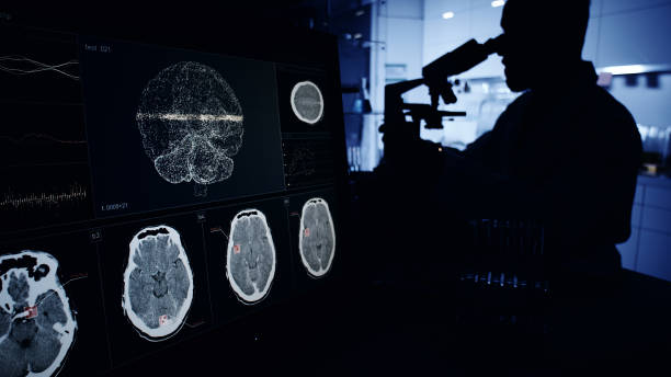 神經系統疾病發病機制復雜，涉及基因突變、衰老過程等多種因素。