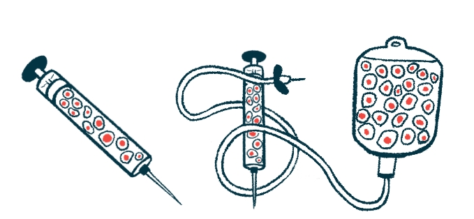 免疫調節(jié)性Tregs增強干細胞治療帕金森病的研究