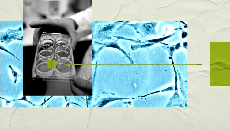 研究人員稱，大腦研究可能有助于開發新的精神分裂癥治療方法。