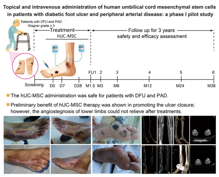 探索干細胞對糖尿病足愈合的療效和機制。