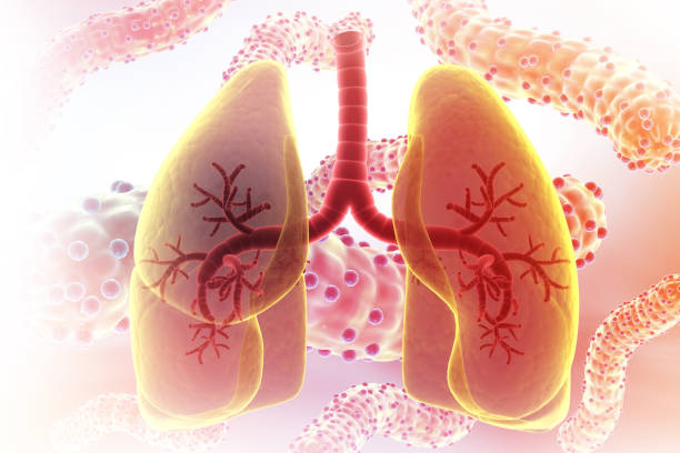 獲得國家藥監局批準！廣州醫科大學附屬第一醫院正在開展人臍帶源間充質干細胞注射液治療IPF臨床研究