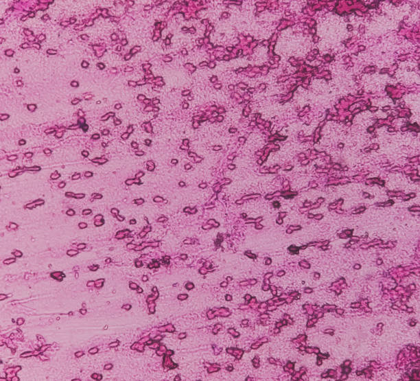 人羊膜上皮細(xì)胞對中樞神經(jīng)系統(tǒng)損傷和疾病的治療潛力