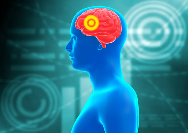 中風患者的康復策略有哪些? 中風患者的康復策略有哪些?