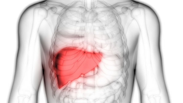 面對肝衰竭，你知道如何選擇最佳治療方案嗎？