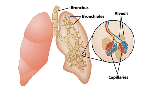 慢性阻塞性肺病如何影響肺部? 慢性阻塞性肺病如何影響肺部?