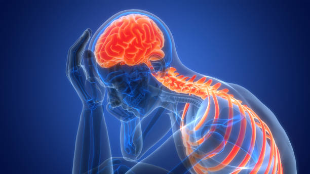 什么是缺血性腦中風，癥狀、原因、診斷和治療