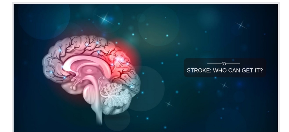 中風的癥狀和體征是什么-哪些人容易患中風?