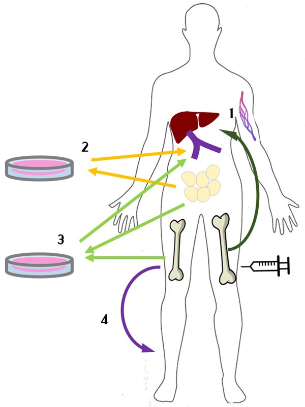 圖1:間充質干細胞治療1型糖尿病方法示意圖。 圖1:間充質干細胞治療1型糖尿病方法示意圖。