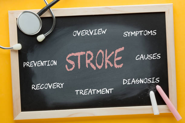 科普丨什么是中風？干細胞治療中風的機制與臨床研究進展