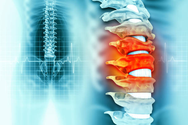 脊髓損傷的癥狀和原因是什么?及其治療方法 脊髓損傷的癥狀和原因是什么?及其治療方法