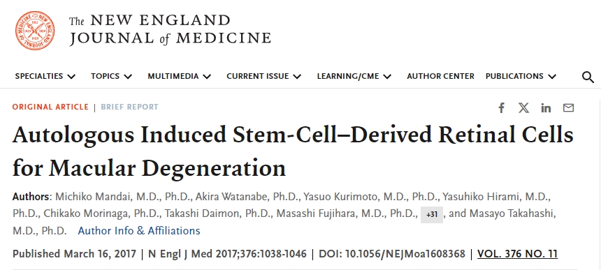 自體誘導干細胞來源的視網膜細胞用于治療黃斑變性