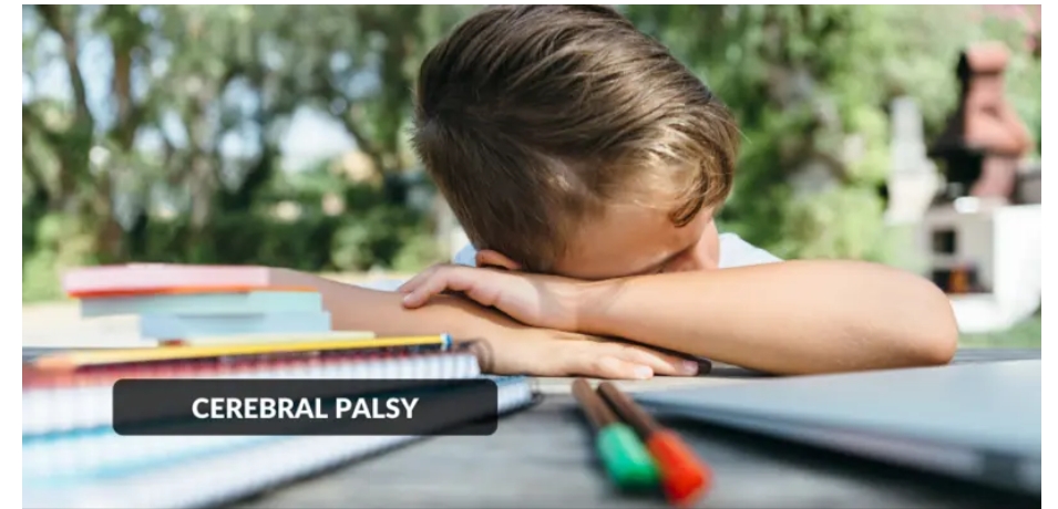 腦癱-原因、癥狀、類型和治療方法