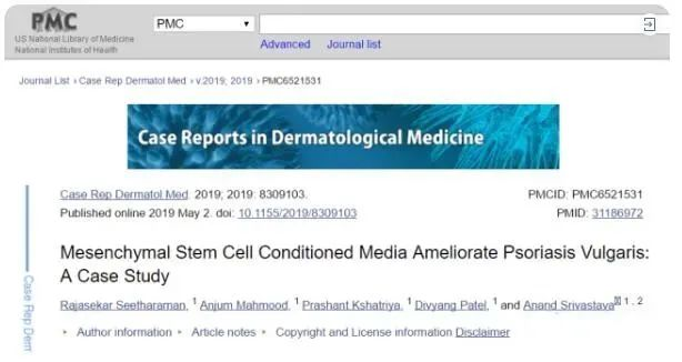 2019年干細(xì)胞治療銀屑病臨床案例 2019年干細(xì)胞治療銀屑病臨床案例
