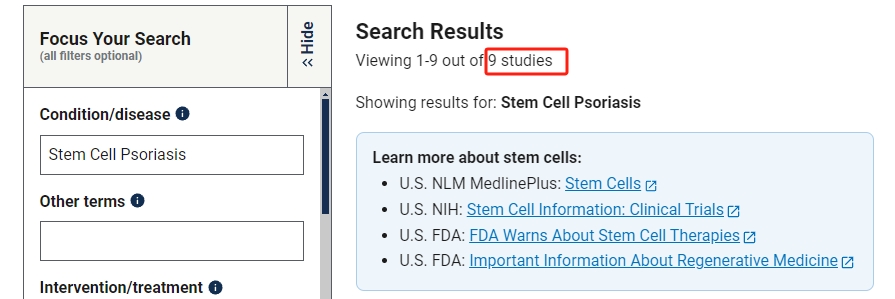 干細(xì)胞治療銀屑病的臨床研究進(jìn)展 干細(xì)胞治療銀屑病的臨床研究進(jìn)展