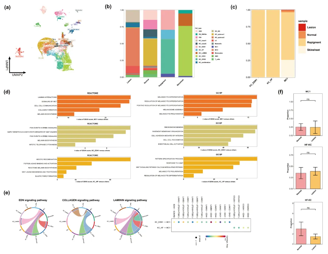 2024年干細胞治療白癜風臨床案例 2024年干細胞治療白癜風臨床案例