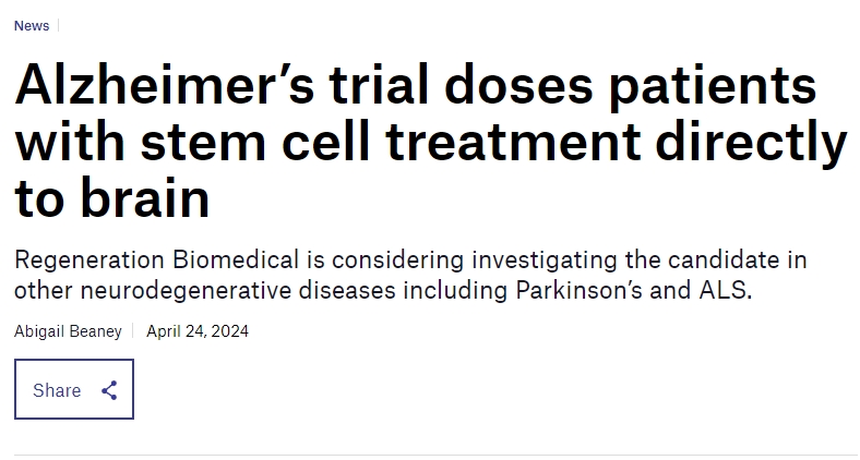 阿爾茨海默氏癥試驗將干細胞直接注入患者大腦 阿爾茨海默氏癥試驗將干細胞直接注入患者大腦