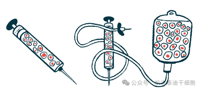 帕金森今日新聞:研究表明,低劑量TED-A9細(xì)胞療法可緩解帕金森病的運動癥狀 帕金森今日新聞:研究表明,低劑量TED-A9細(xì)胞療法可緩解帕金森病的運動癥狀