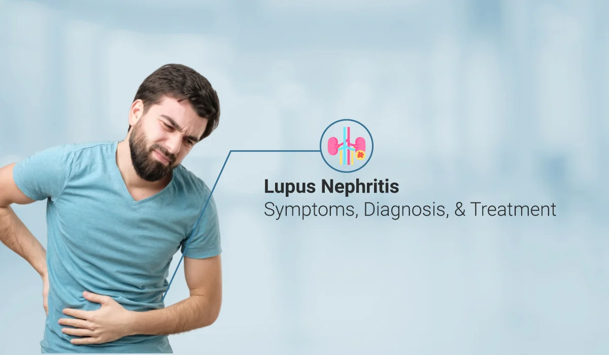 狼瘡性腎炎癥狀與發病原因 狼瘡性腎炎癥狀與發病原因