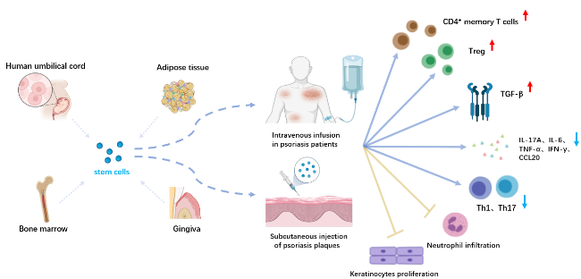 圖1:干細胞在牛皮癬治療中的應用 圖1:干細胞在牛皮癬治療中的應用