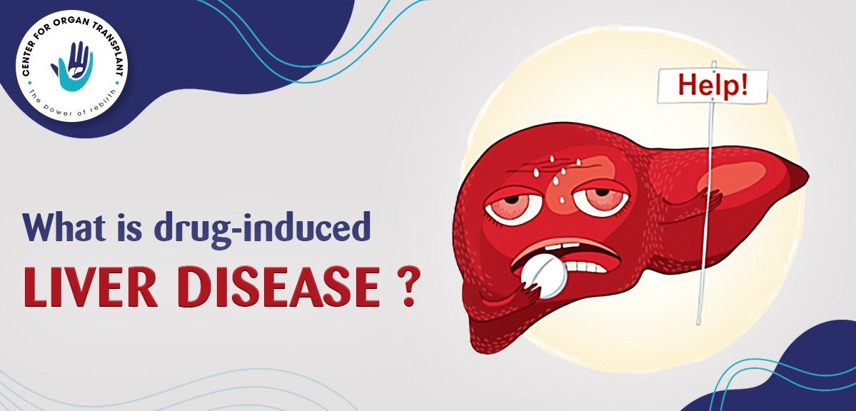 什么是藥物性肝衰竭-癥狀、原因和治療 什么是藥物性肝衰竭-癥狀、原因和治療