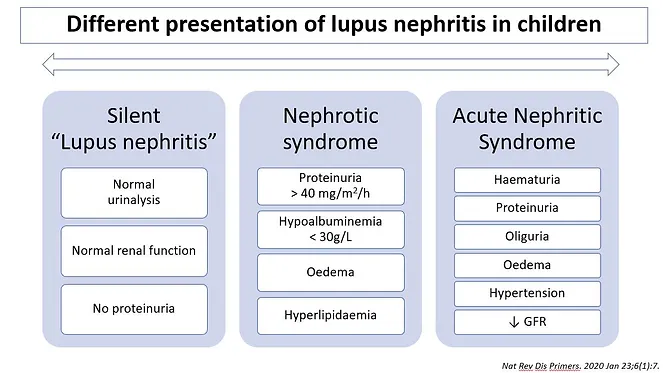 兒童狼瘡性腎炎的不同表現(xiàn) 兒童狼瘡性腎炎的不同表現(xiàn)