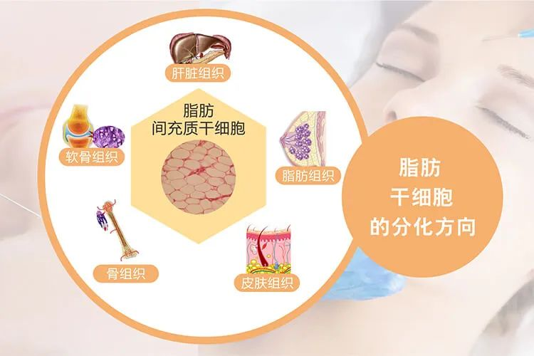 什么是脂肪干細(xì)胞：脂肪干細(xì)胞來源、臨床應(yīng)用