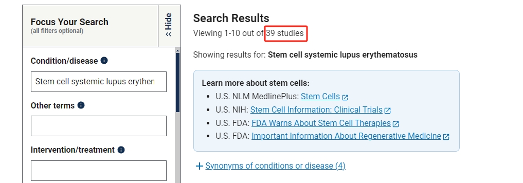 干細胞治療系統性紅斑狼瘡臨床研究項目有39項。其中國內發布的占據8項。 干細胞治療系統性紅斑狼瘡臨床研究項目有39項。其中國內發布的占據8項。
