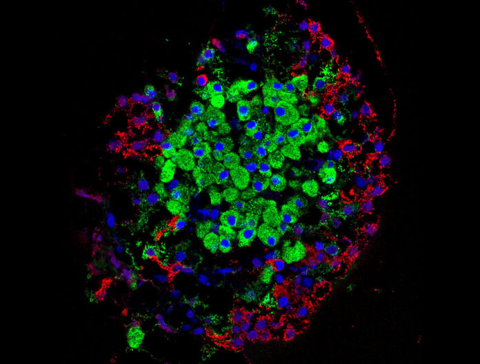 分離的胰島。胰島產生的激素由幾種細胞直接分泌到血流中,包括β細胞(綠色)和α細胞(紅色)。 分離的胰島。胰島產生的激素由幾種細胞直接分泌到血流中,包括β細胞(綠色)和α細胞(紅色)。