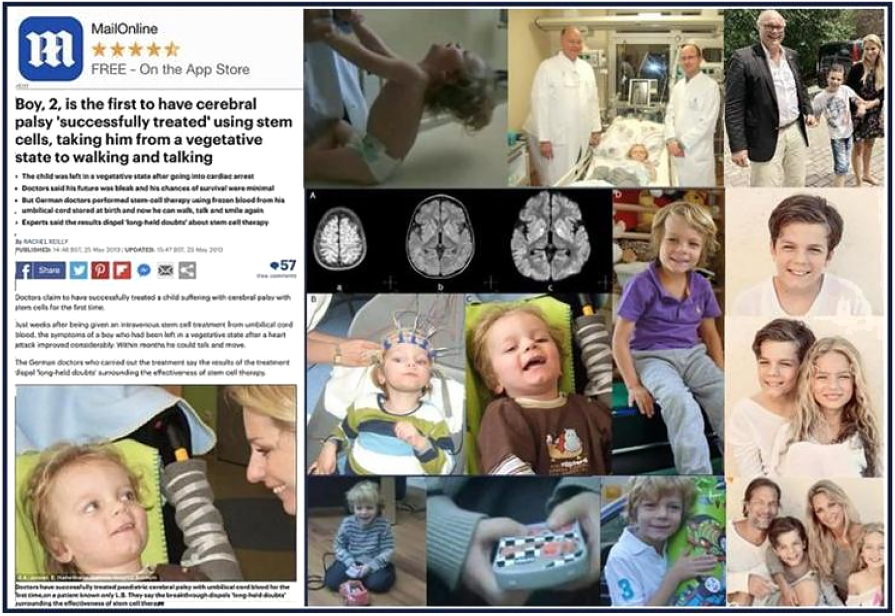 因心臟驟停引起的全身缺氧缺血而患上腦性癱瘓 因心臟驟停引起的全身缺氧缺血而患上腦性癱瘓