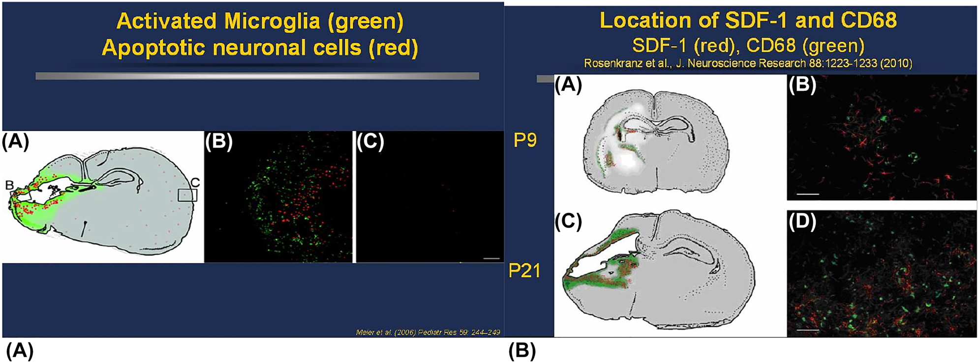 新生大鼠PN9和 PN21 HI后激活的小膠質細胞和SDF-1表達 新生大鼠PN9和 PN21 HI后激活的小膠質細胞和SDF-1表達