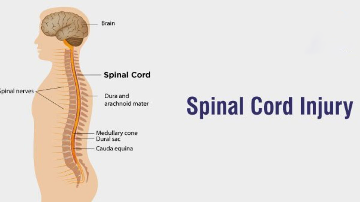 3項研究75例患者,評估干細胞治療脊髓損傷的安全性和有效性 3項研究75例患者,評估干細胞治療脊髓損傷的安全性和有效性