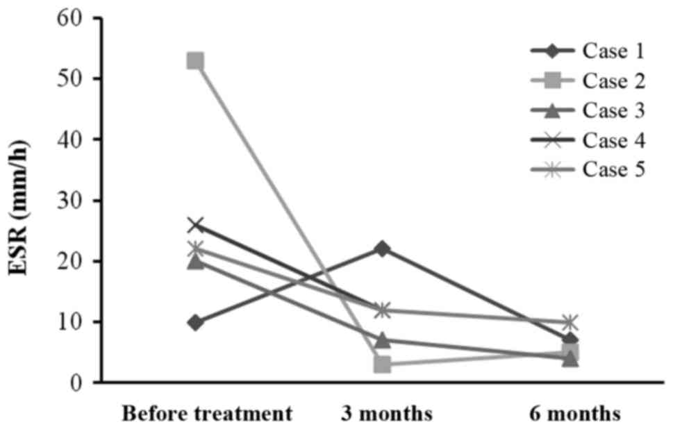 每位患者治療前后的 CRP 水平。1 名患者的 CRP 水平降低，而其他 4 名患者的 CRP 水平保持穩定并在正常范圍內。CRP，C 反應蛋白。