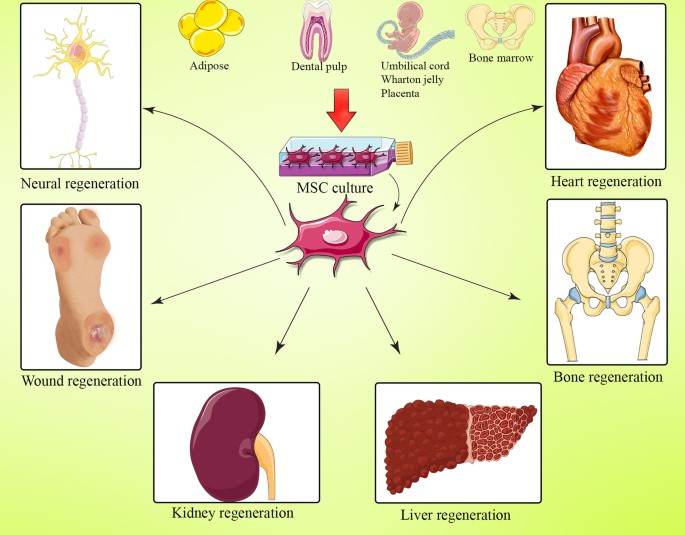 間充質干細胞(MSC) 是一種多能細胞，可分化為基質譜系細胞。間充質干細胞(MSC) 是骨髓 (BM-MSC)、脂肪組織、肝臟、羊水、胚胎胎盤、臍帶血和其他組織中的一組非造血細胞。骨髓間充質干細胞能夠抑制與GVHD病理生理學有關的大多數免疫細胞的激活和功能。