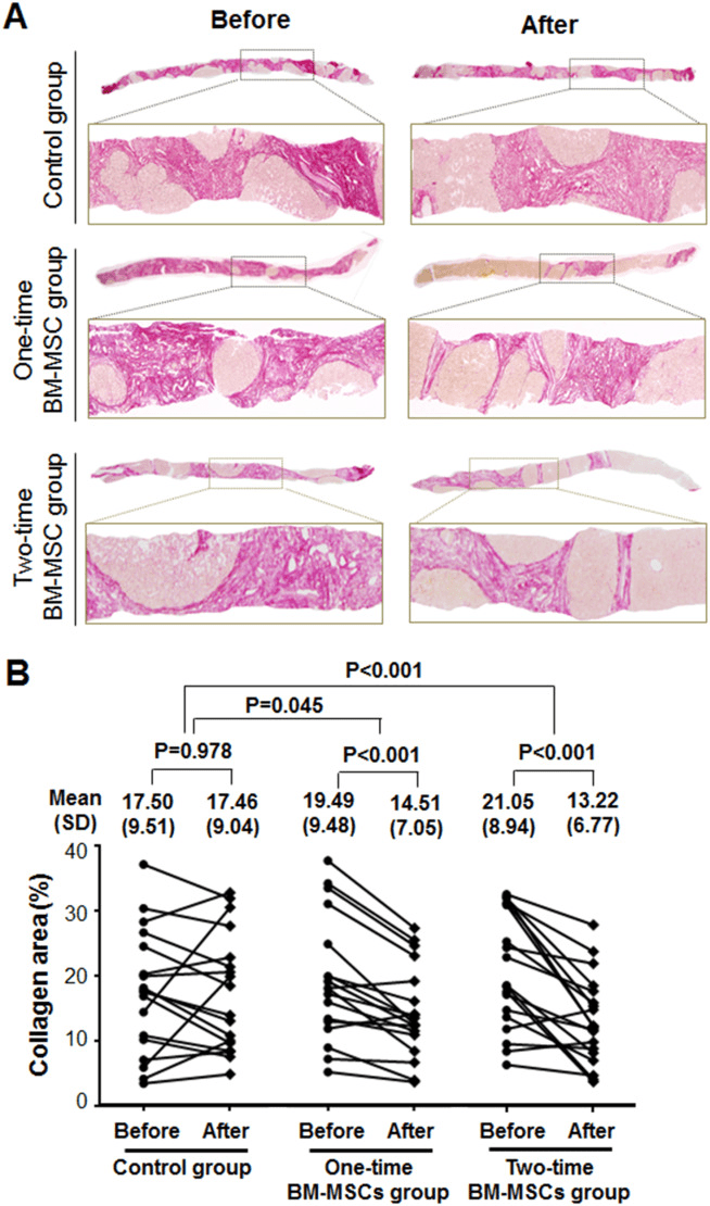 膠原蛋白面積的定量組織學分析。