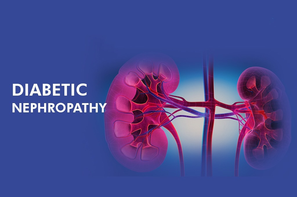 干細胞治療糖尿病腎病患者16例，能夠有效控制血糖，改善腎功能