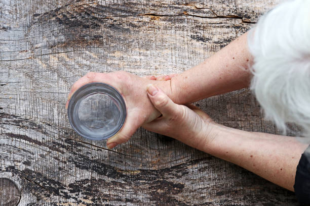 治療帕金森病的方案有那5大種?目前干細胞治療帕金森病前景如何? 治療帕金森病的方案有那5大種?目前干細胞治療帕金森病前景如何?